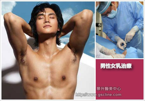 第三代威塑溶脂和雷射溶脂男性女乳症治疗 引进第三代威塑溶脂和雷射溶脂男性女乳症治疗技术