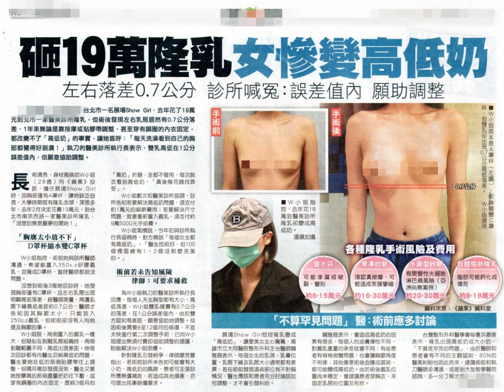 從一個女性隆乳後變成高低奶的新聞談起