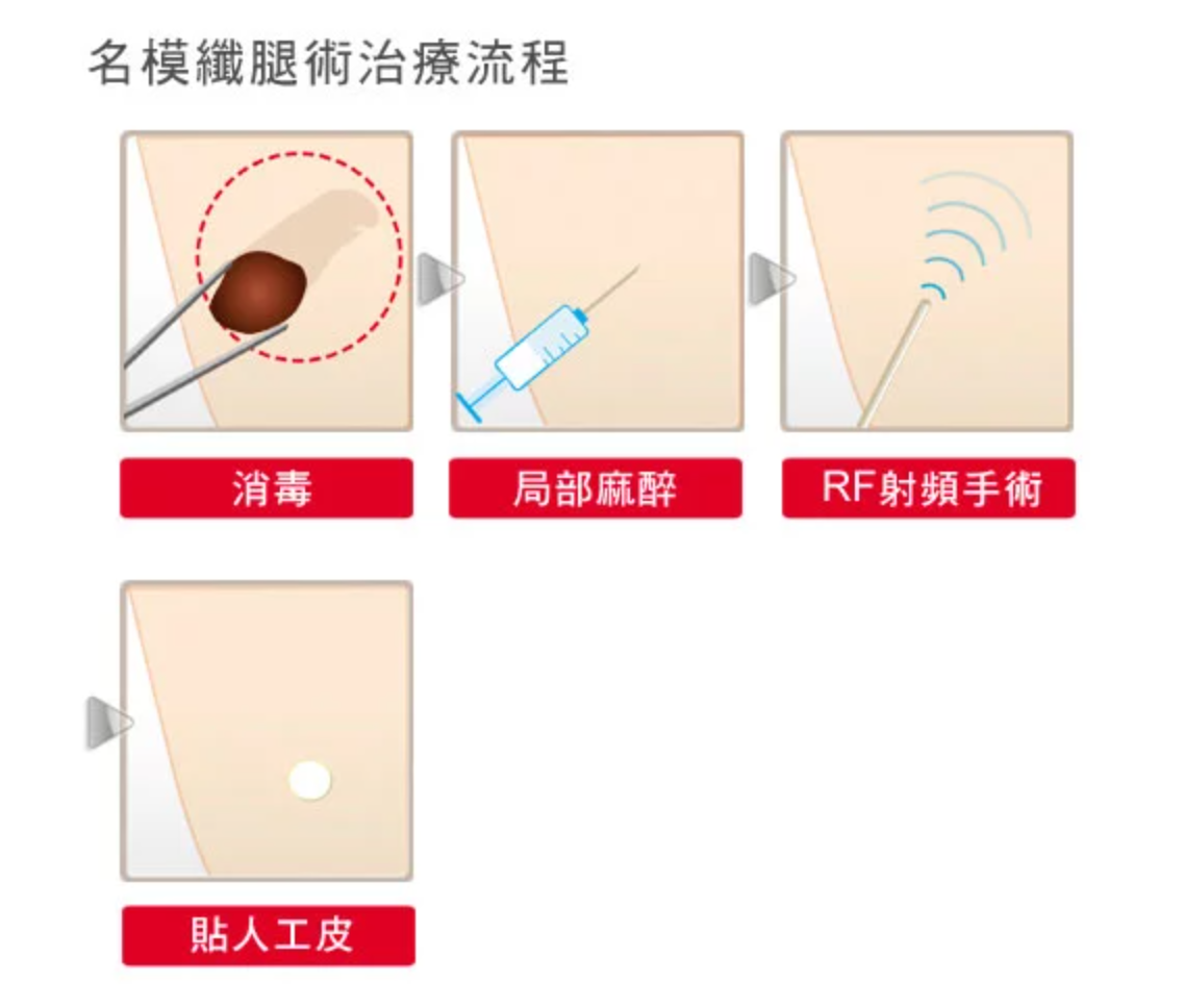 景升診所 自體脂肪論文 連續七年刊登國際期刊 5招瘦小腿肌肉：告別粗壯蘿蔔腿的新方法！ 6 2 2024 最新指南