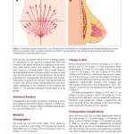 Autologous Fat Grafting for Breast Augmentation in Underweight Women