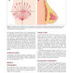 景升診所 自體脂肪論文 連續七年刊登國際期刊 Autologous Fat Grafting for Breast Augmentation in Underweight Women Aesthetic Surgery Journal 2014 Chiu 1090820X14540679 頁面 05 2024 最新指南