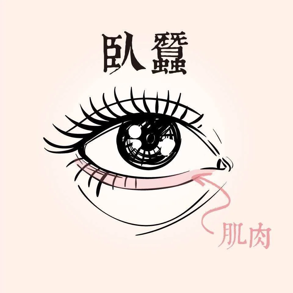 眼袋-不動手術的眼袋去除法 9 臥蠶是下眼臉邊緣因為肌肉收縮而形成的一條組織