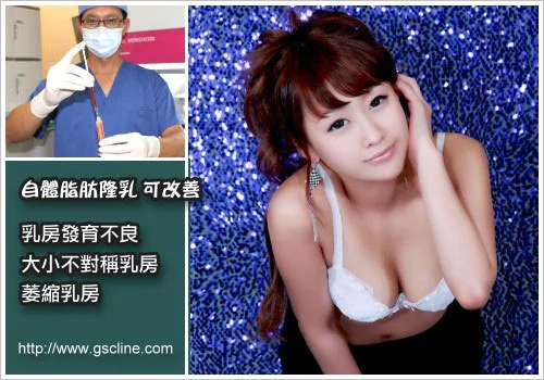 自體脂肪移植隆乳避免術後壞死的重點 4 ▲自體脂肪移植隆乳避免術後壞死要注意幾件事情