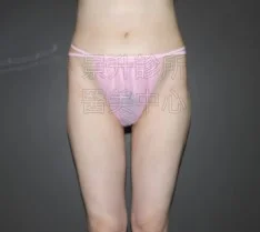 美腿後