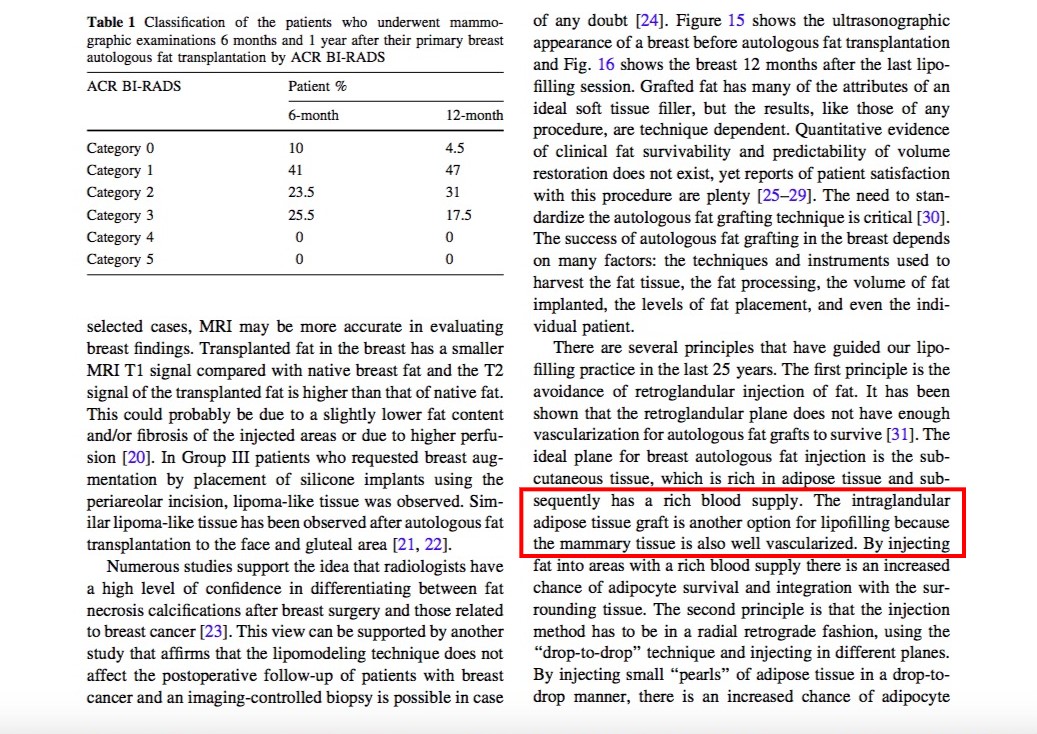 法國醫師 Illouz 在一篇『自體脂肪隆乳25年的經驗』論文中，認為脂肪打到乳腺反而可以提高脂肪的存活率