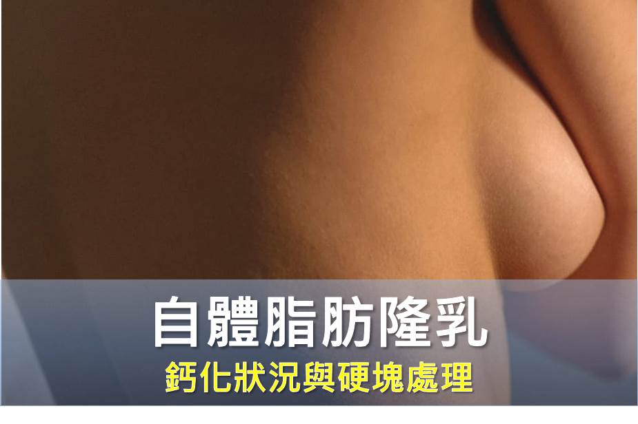 自體脂肪隆乳鈣化狀況與硬塊處理