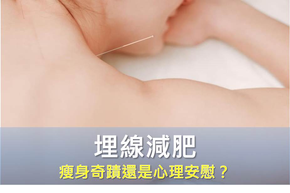 埋線減肥：瘦身奇蹟還是心理安慰？