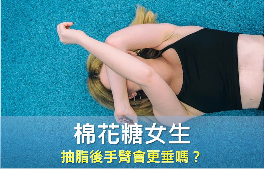 棉花糖女生抽脂後手臂會更垂嗎？