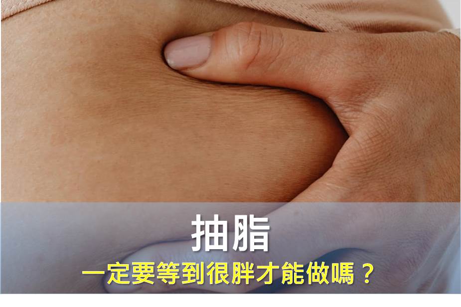 一定要等到很胖才能抽脂嗎？現在，想雕哪就能雕哪！