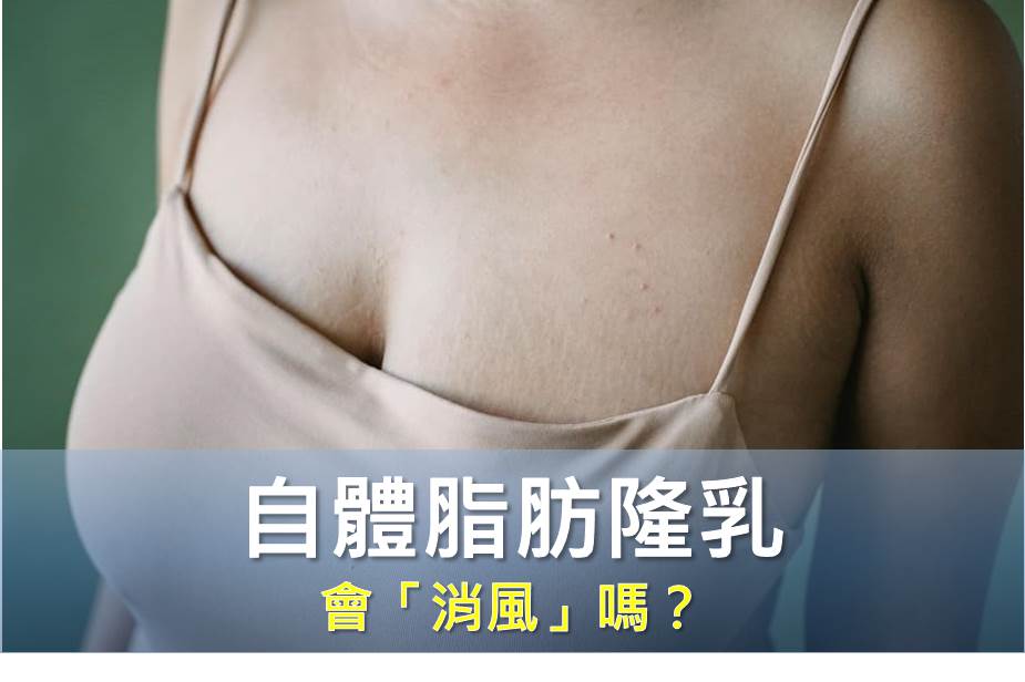 自體脂肪隆乳會「消風」嗎？