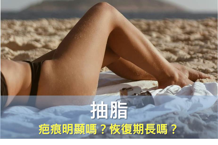 告別抽脂「恢復期魔咒」！現代醫美輕鬆讓疤痕「隱形」、疼痛「神隱」、恢復「縮短」