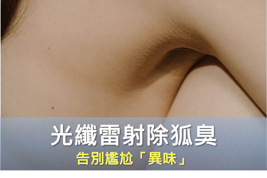 告別尷尬「異味」：光纖雷射除狐臭，如何用微創科技優雅重拾清新自信？