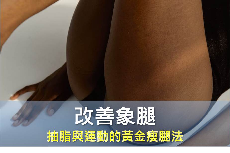 狂做高抬腿會讓「象腿」更粗？解析抽脂與耐力運動的黃金瘦腿法則