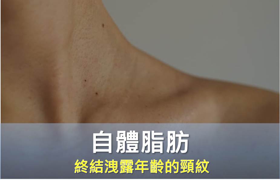 自體脂肪填充 - 終結洩露年齡的「火雞脖」與「頸紋圈」