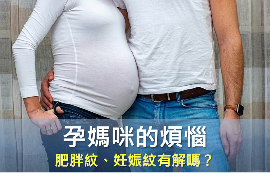 孕媽咪的煩惱 肥胖紋、妊娠紋有解嗎？