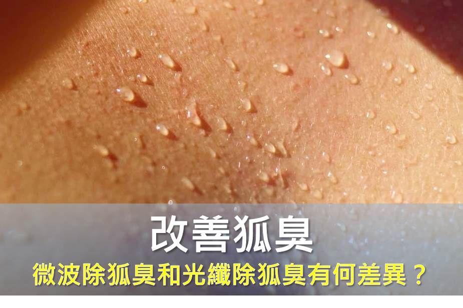 微波除狐臭Miradry和光纖除狐臭有何差異？