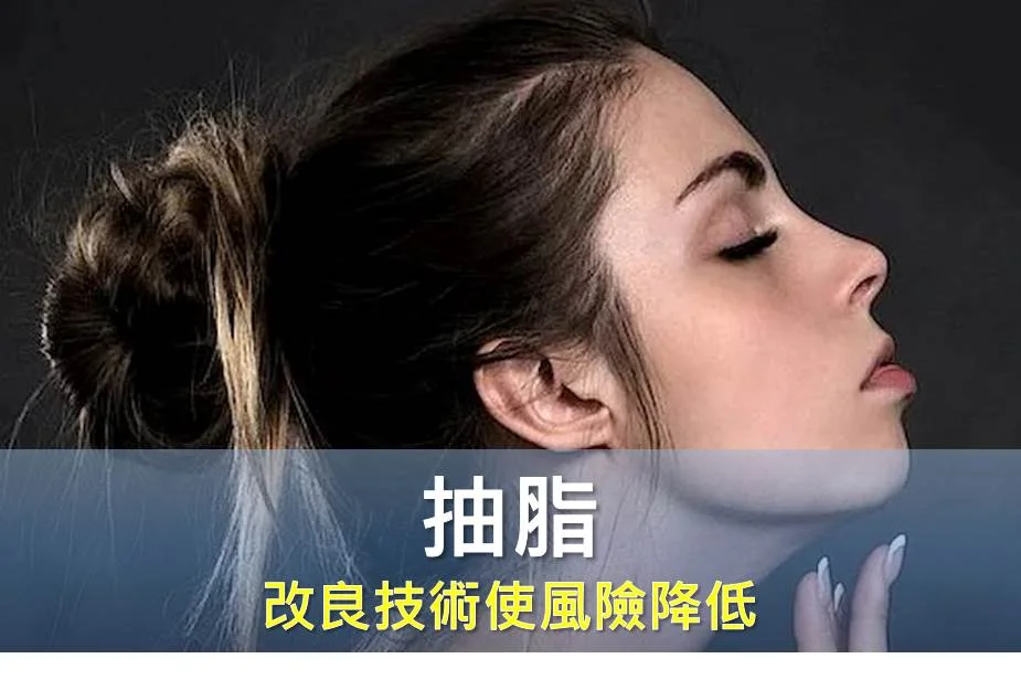 抽脂 改良技術使風險降低