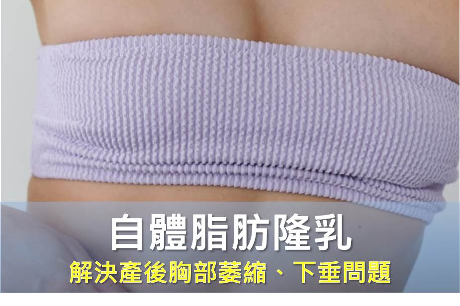 自體脂肪隆乳 解決產後胸部萎縮、下垂問題