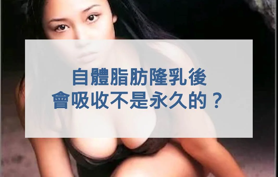 自體脂肪隆乳後會吸收，不是永久的？