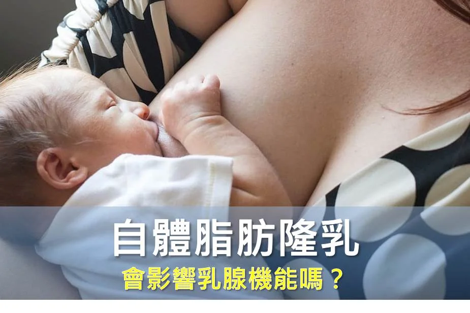 自體脂肪隆乳會影響乳腺機能嗎？生完小孩後多久可以做？