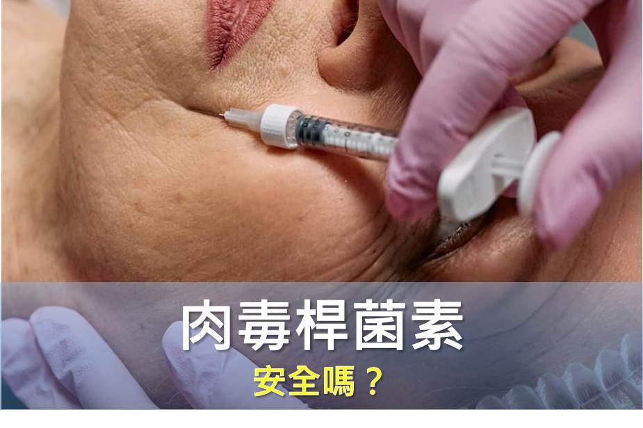 肉毒到底安全嗎？為什麼很多人打完有副作用？