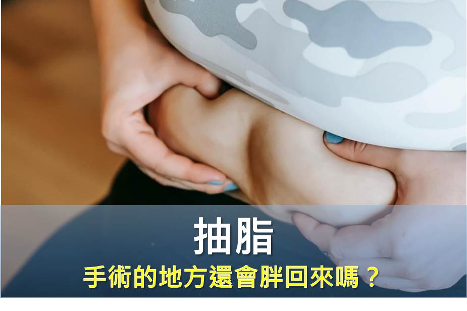 抽脂後手術的地方還會胖回來嗎？注意這些就不怕了