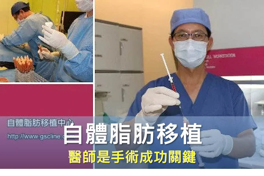 自體脂肪移植存疑慮？ 選擇專業醫師成關鍵
