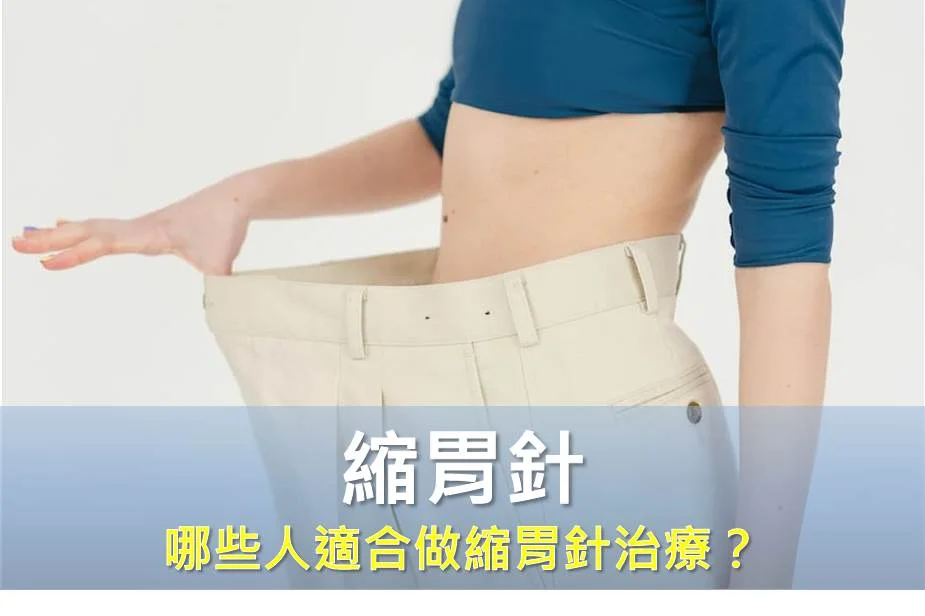 哪些人適合做縮胃針治療？