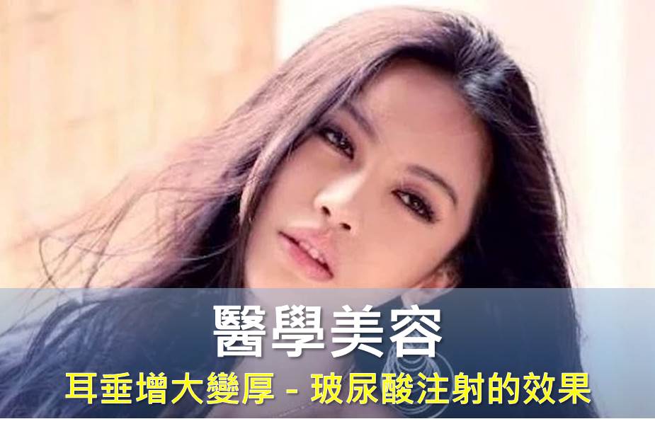 耳垂增大變厚--玻尿酸注射的效果