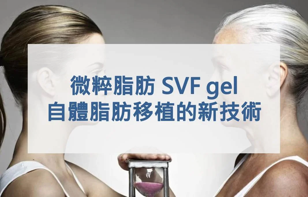 微粹脂肪 SVF gel-自體脂肪移植的新技術
