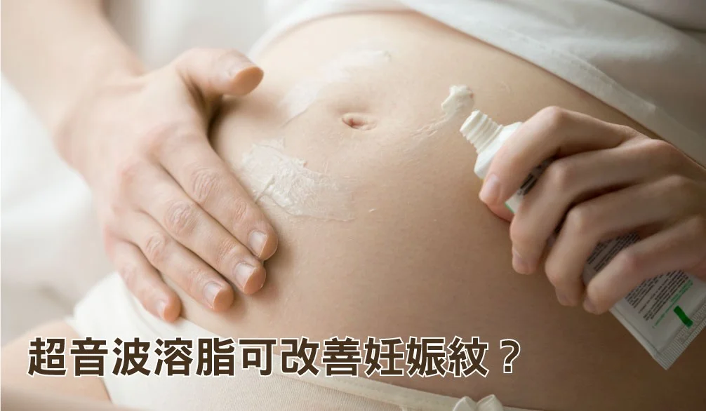 超音波抽脂可改善妊娠紋嗎？
妊娠紋淡化：恢復光滑緊實肌膚
