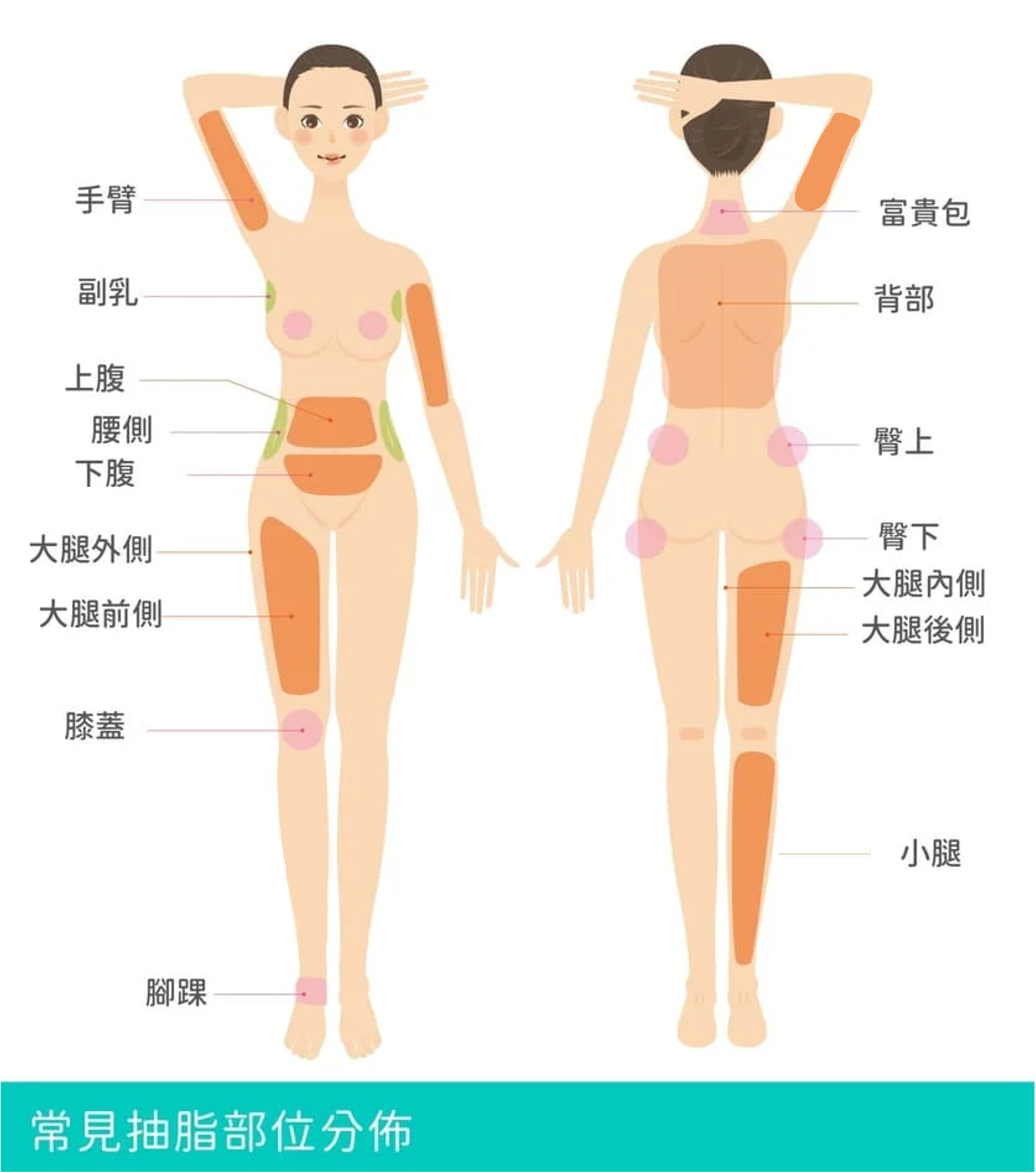 常見抽脂部位