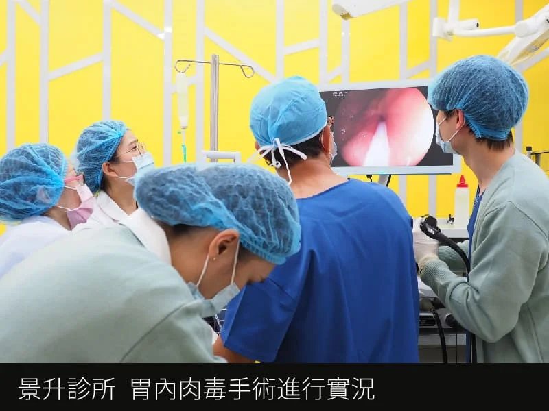 突破減重極限:7個胃肉毒與縮胃針療程的成功秘訣 11 胃肉毒_胃肉毒手術實況_景升診所