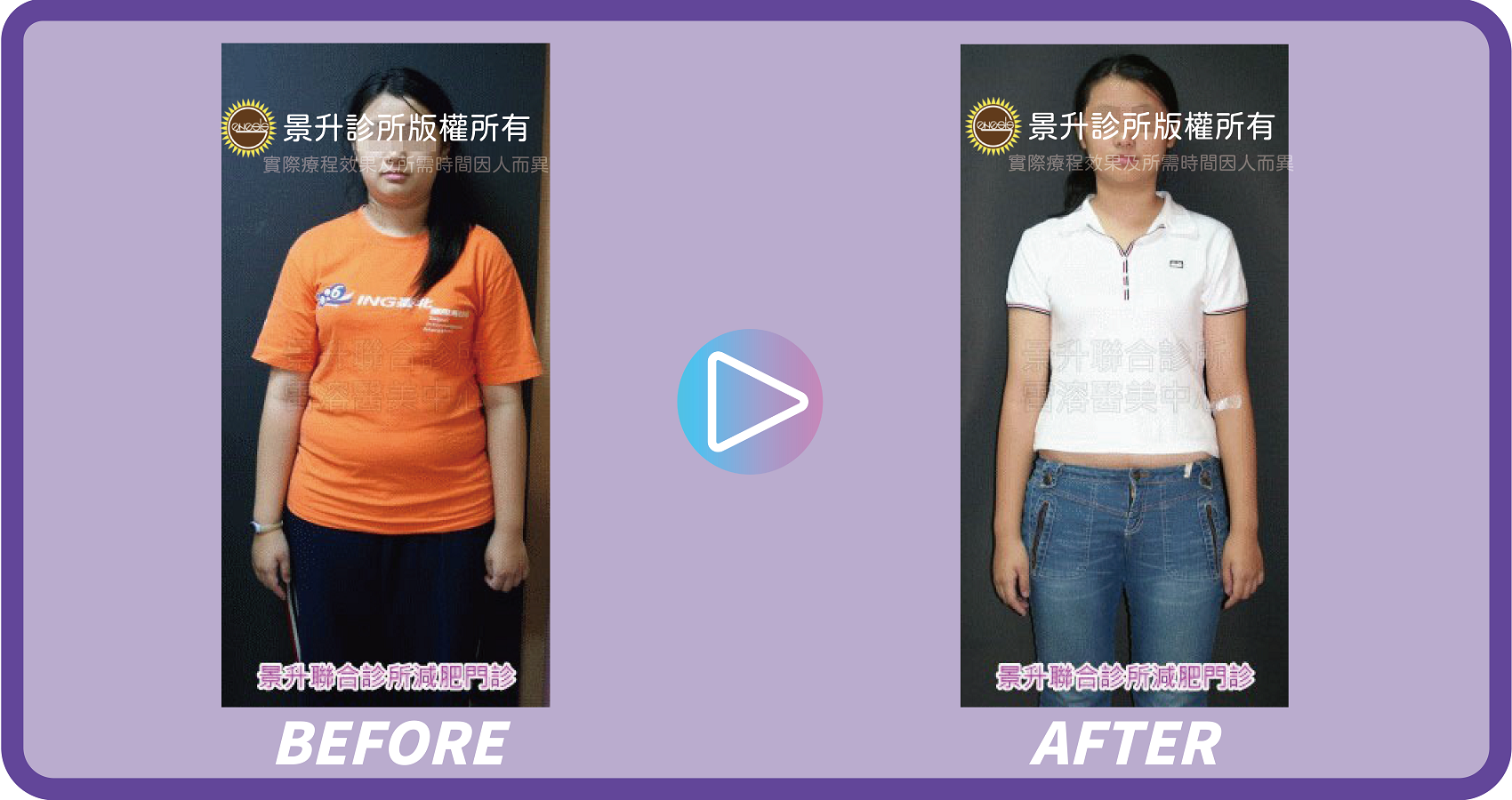 肥胖症治療 量身規劃減重計畫 - 景升診所 景升診所 自體脂肪論文 連續七年刊登國際期刊 肥胖症治療 量身規劃減重計畫 案例2 13
