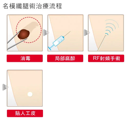 ▲ 快速瘦小腿：名模纖腿術 治療流程