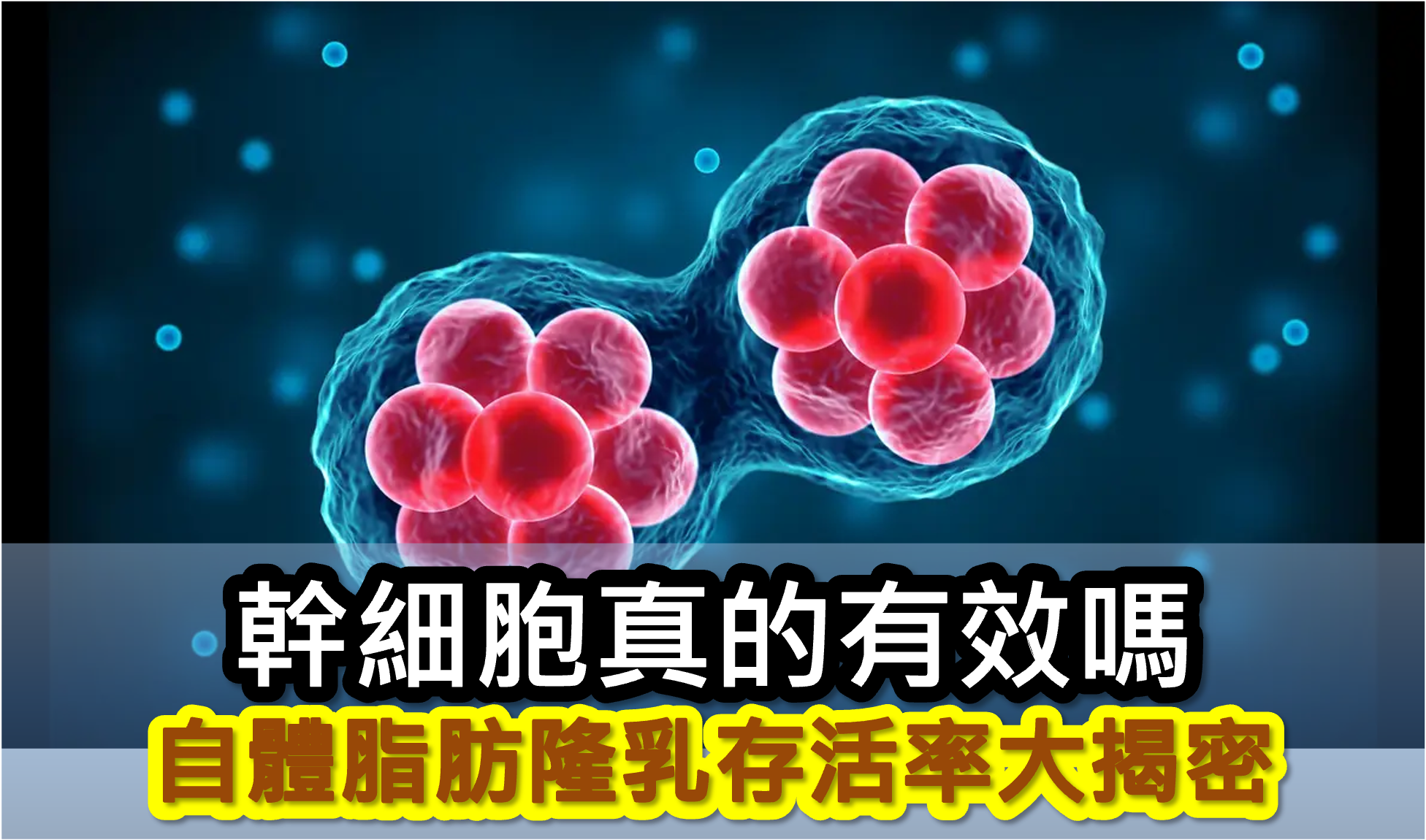 邱正宏醫師自體脂肪隆乳論文：SVF幹細胞能夠增加自體脂肪隆乳脂肪存活率